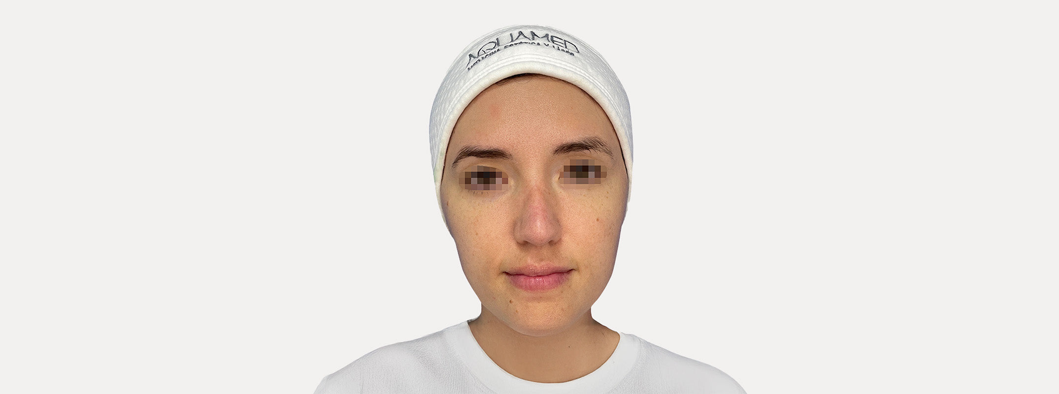 A woman after receiving a Led Light Therapy Deep Facial.