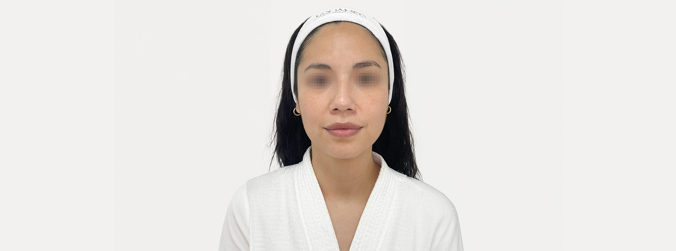 A woman's face after receiving an afrodita facial.