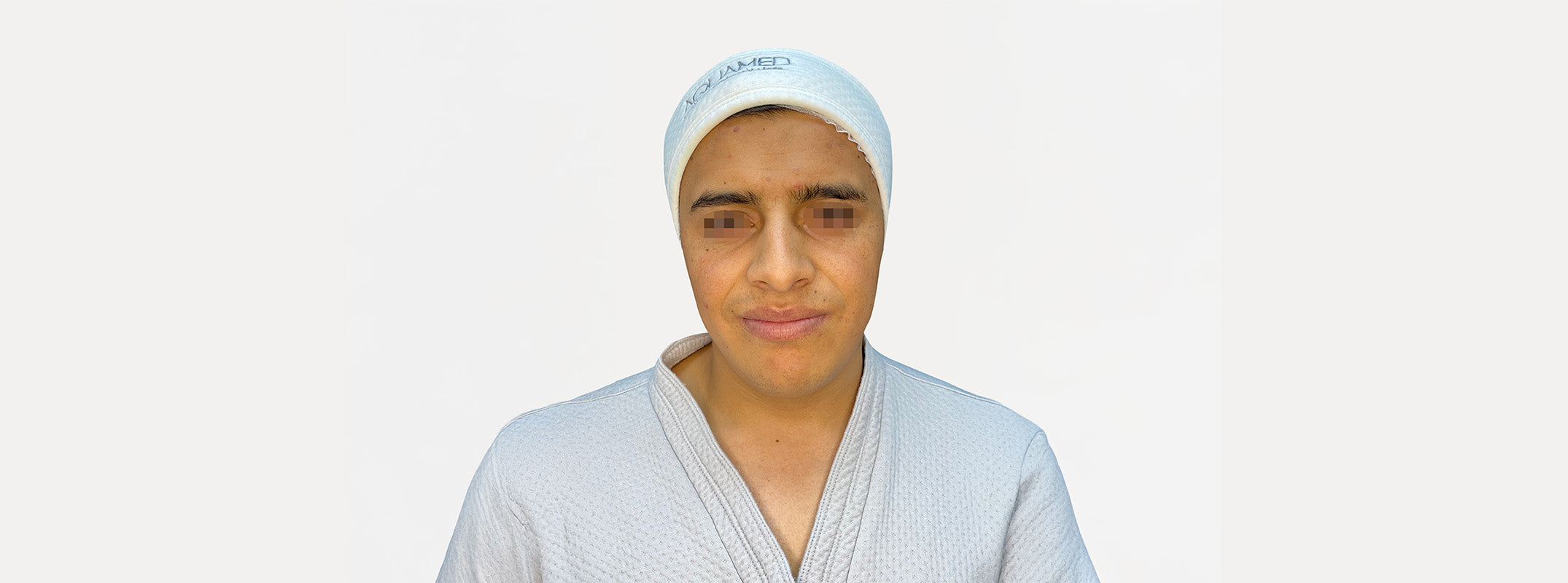 Front view of a man's face after receiving a bardana facial.