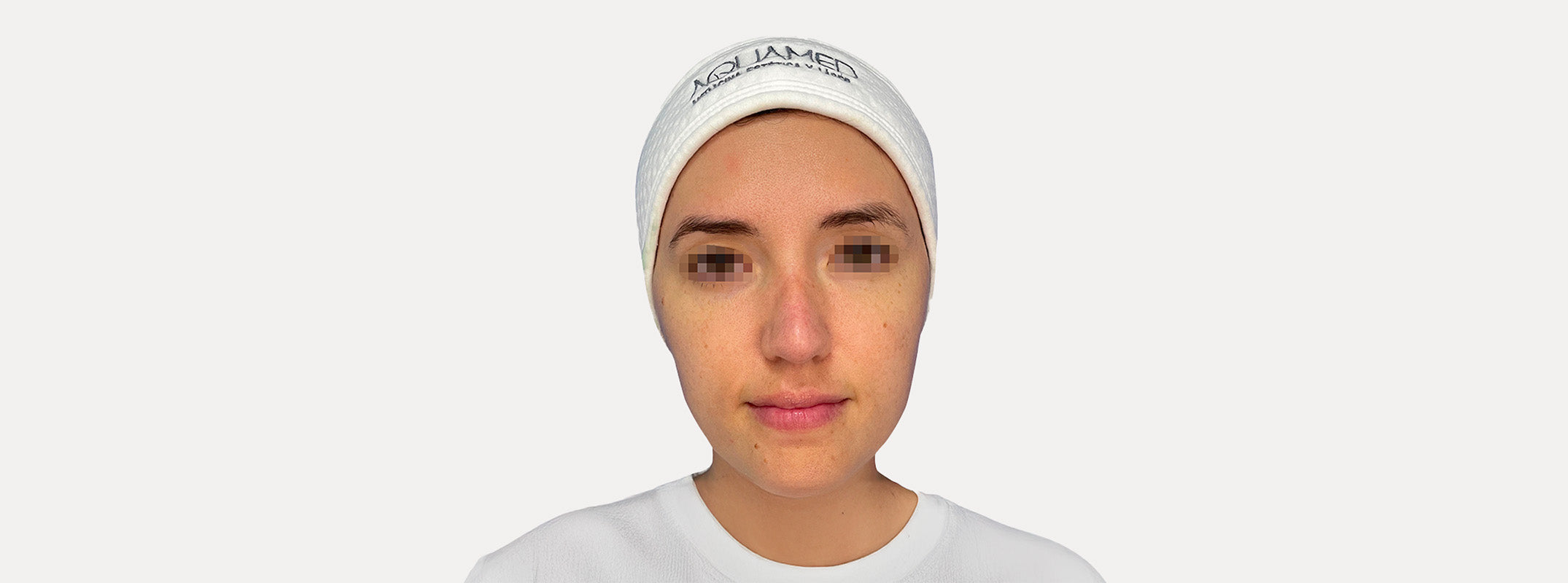 A woman's face after receiving a european facial.