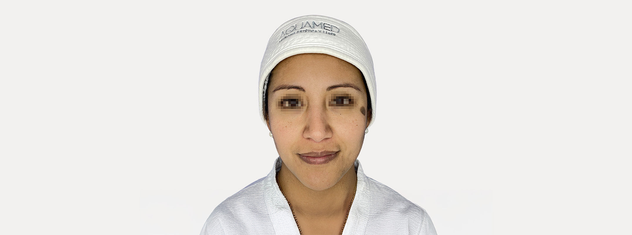 A woman's face after receiving a pink antioxidant facial.