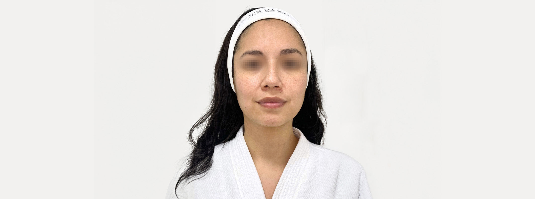 A woman's face before receiving an afrodita facial.