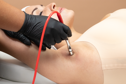 A woman receiving a cosmetic treatment on her underarm.