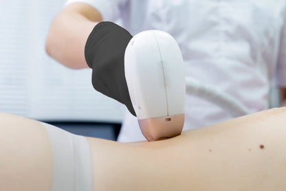 A person receiving laser hair removal on their back.