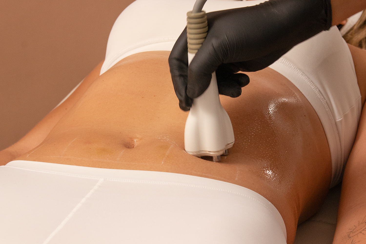 A woman receiving a cosmetic treatment on her abdomen. 